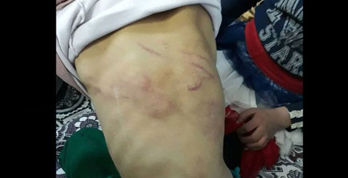 Gaziantep'te babasından işkence gören çocuk yuvaya yerleştirildi