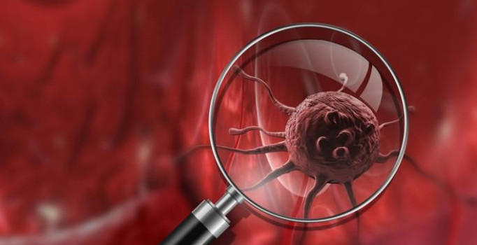 BM’den kanser vakalarına karşı çağrı