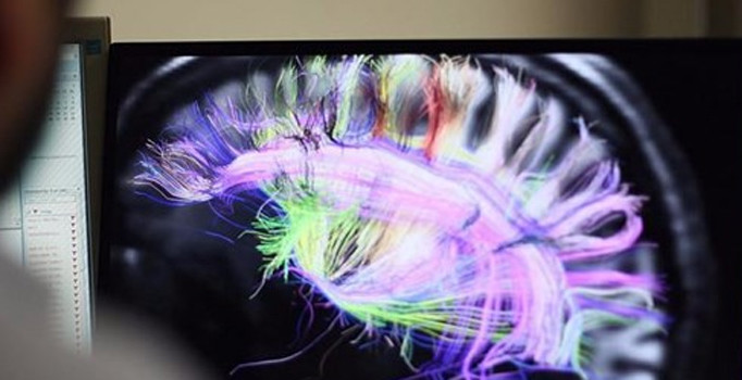 Elektrik şokları hafızayı yüzde 15 geliştiriyor