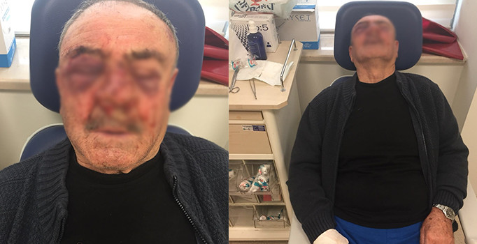 Komşusundan aidat istedi hastanelik oldu | İzmir haberleri