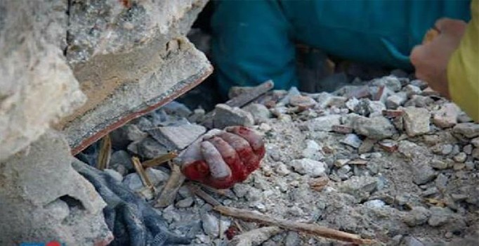 Kanada, Rusya'nın Suriye’deki hastane saldırısını kınadı