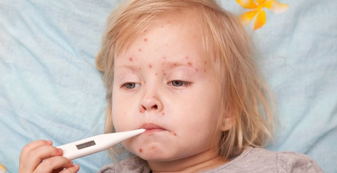 Avrupa’da kızamık vakaları 4 kat arttı