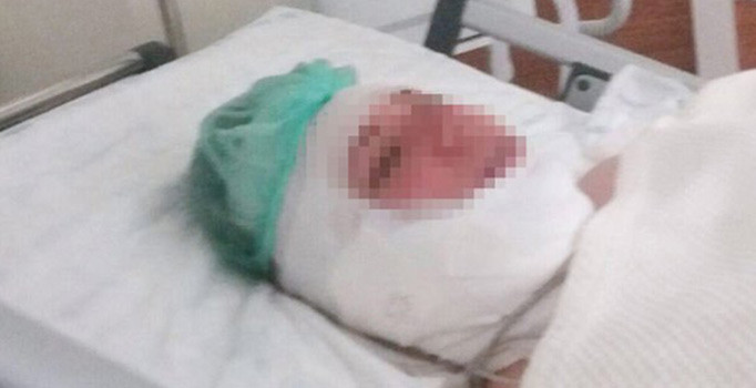 Koca şiddetinden ölü taklidi ile kurtuldu