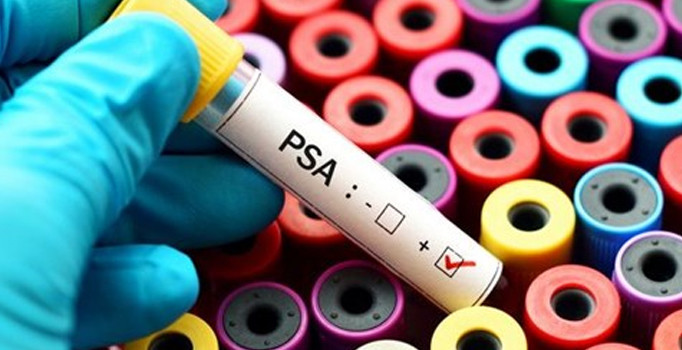 Prostat kanserinde hedefe yönelik tedavi olumlu sonuçlar veriyor