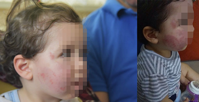 Kreşte dayak skandalı: 1,5 yaşındaki bebeği dövüldüler