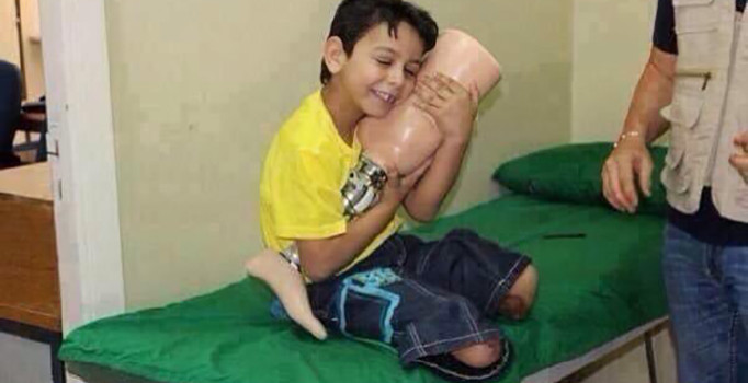 Suriyeli çocuğun protez sevinci