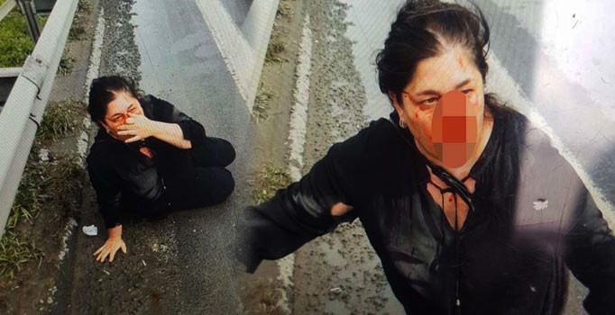 UBER sürücüsünden kadın yolcuya darp! Kanlar içinde kaldı