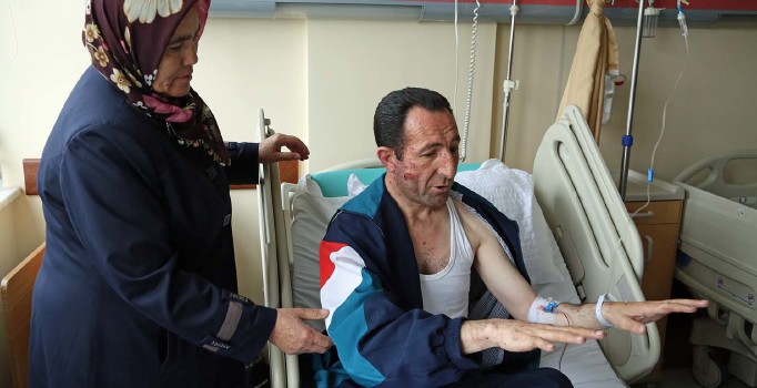 Kızılay saldırısında yaralanan otobüs şoförü Necati Yılmaz o anlar anlattı