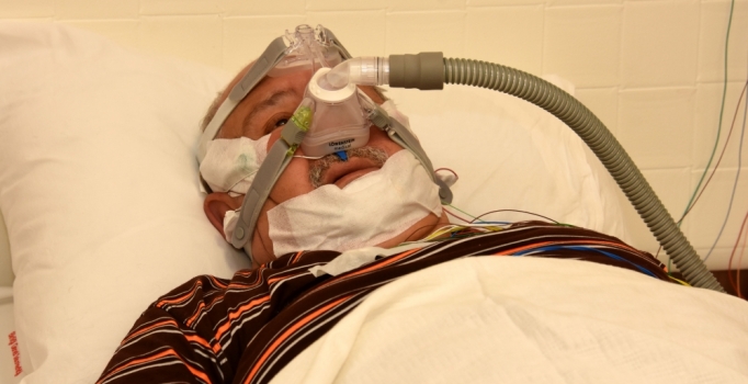 Uyku apnesinde erken teşhis ömrü uzatıyor