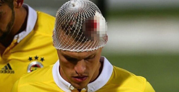 Skrtel kanlar içinde kaldı