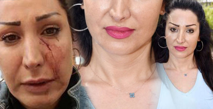 'Patatesi değiştir' dedi, garson yüzüne bıçak fırlattı