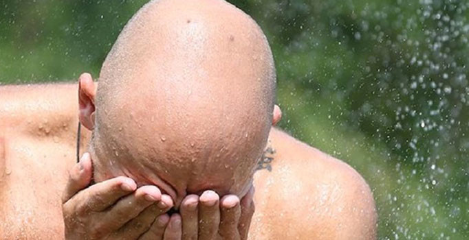 İngiltere kelliğe potansiyel tedavi umudu buldu