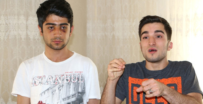 Şanlıurfa'da engelli genç darbedildi