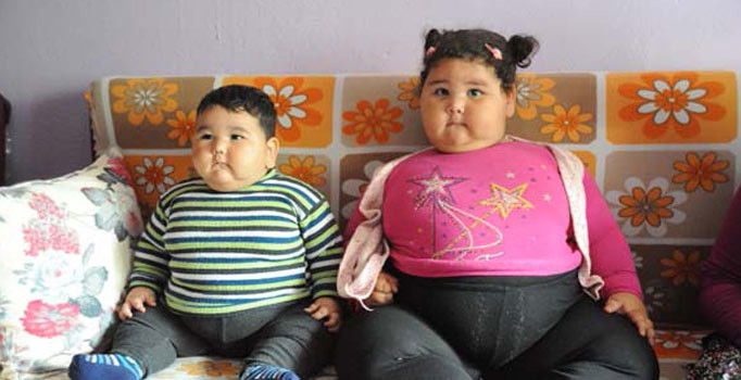 Obez kardeşlerin dramı yürek burktu