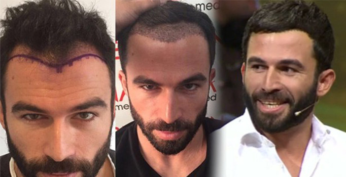 Turbo Turabi yeni imajıyla herkesi şaşırttı