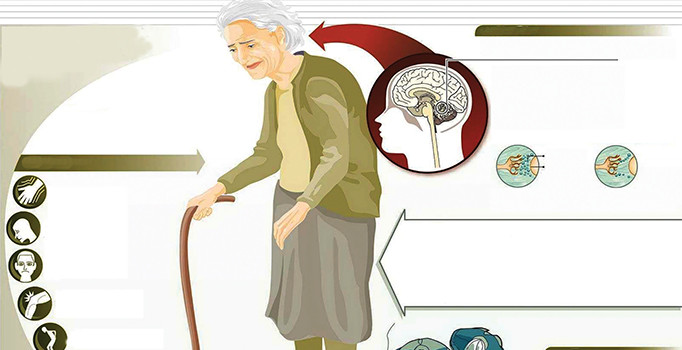 Doç. Dr. Gülsen Babacan: Artık 15 yaşında bile parkinson hastası var