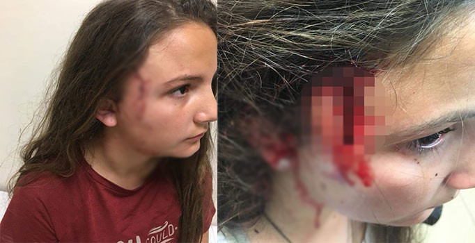 Çocuk parkında pitbul dehşeti