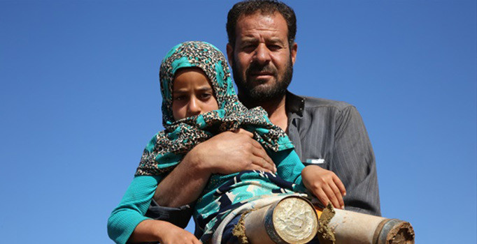 Suriyeli Maya protez tedavisi için İstanbul'da