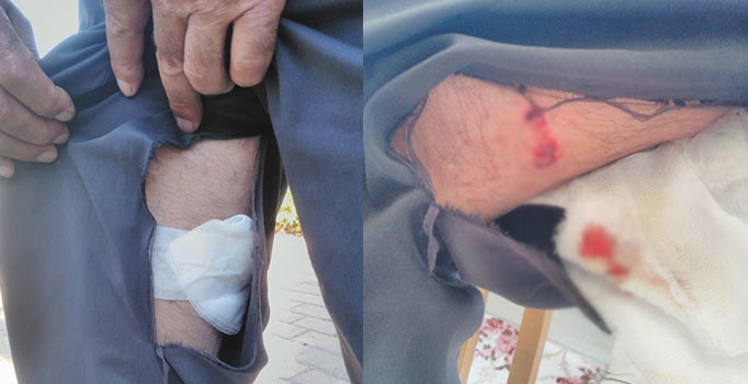 Bursa’da pitbull dehşeti