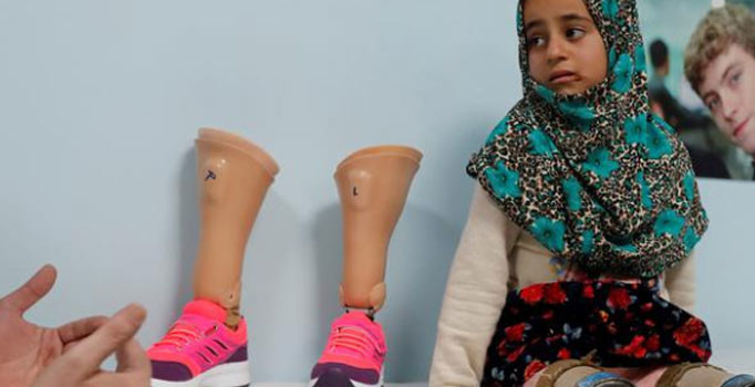 Suriyeli Maya protez ayaklarına kavuştu