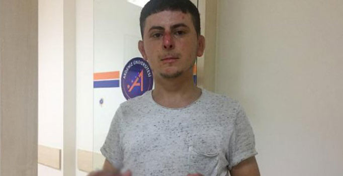 Afrin gazisi tankın vurulma anını anlattı