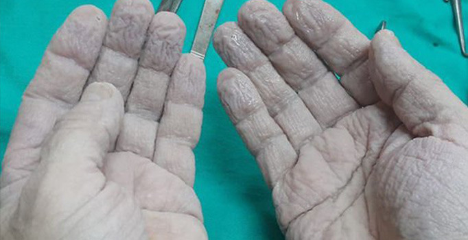 Doktordan yürek burkan paylaşım: ''Dillerde kafaya inen kaldırım taşı, gönüller kırık''