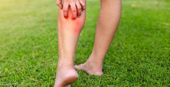 Böcek ısırığı öldürüyor