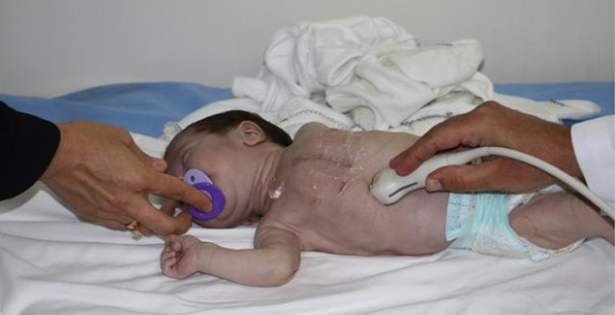 Minik Selim'in kalbi sağda atıyor