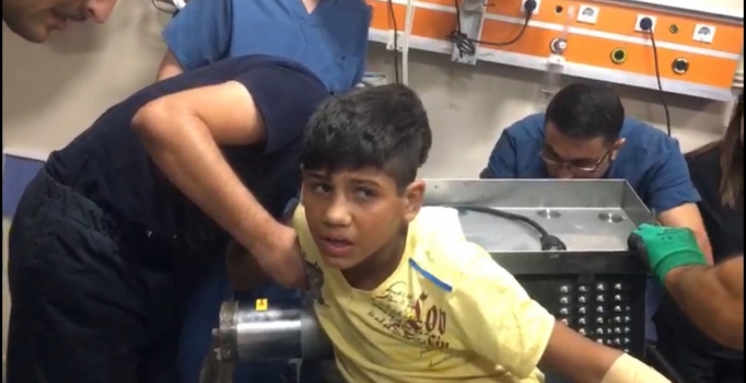 Aksaray'da korkunç kaza: Elini kıyma makinesine kaptırdı, parmakları koptu