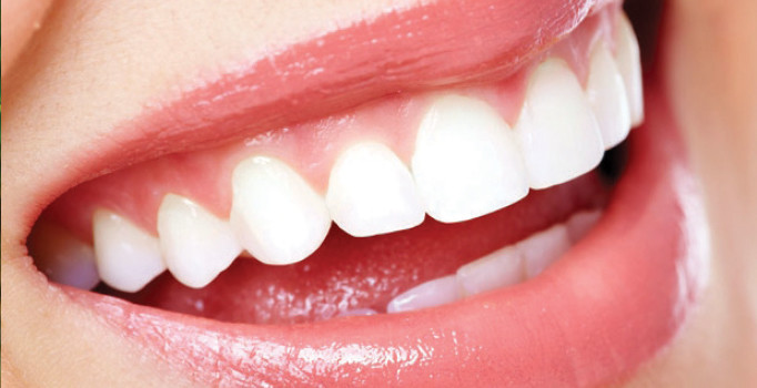 Gülüşünüzle 10 yaş daha gençleşin