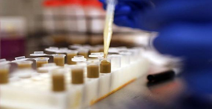 GAİTA nakli nedir? Nasıl uygulanıyor? GAİTA nakli hangi hastalıklarda kullanılıyor?