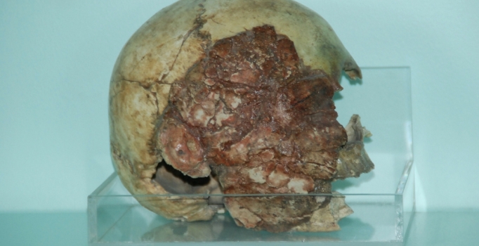 7 bin 500 yıllık kil sıvalı insan kafatası