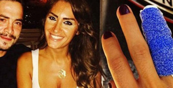 Ahmet Kural Naz Çekem'in parmağını mı kırdı? Naz Çekem kimdir?