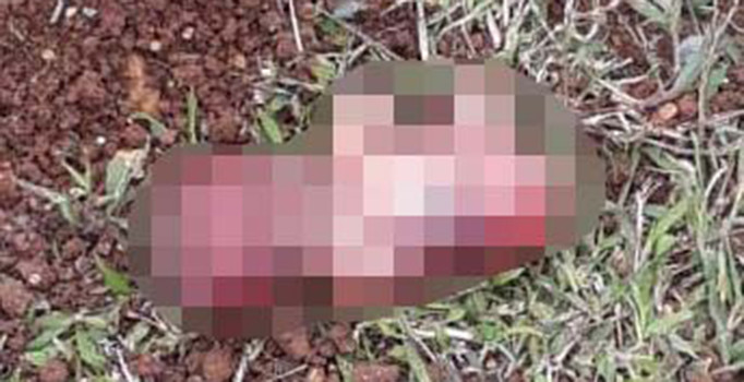 Şanlıurfa'da korkunç görüntü