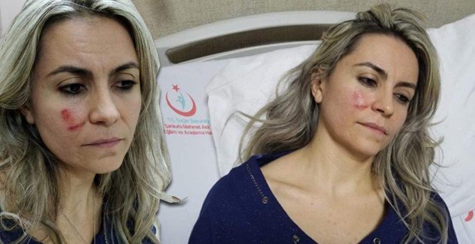 'Çürük' raporu alamadığı için doktora saldırmış