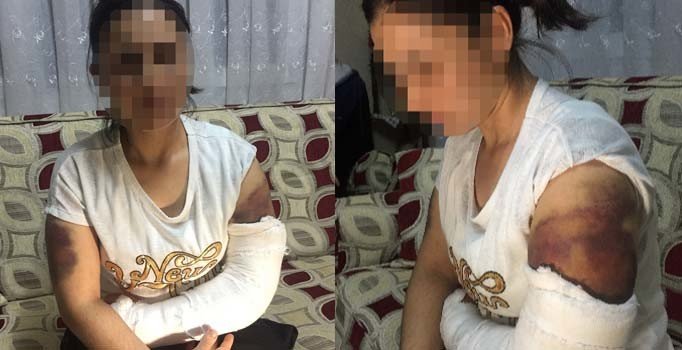 Onu bu hale kocası getirdi! İnşaat demiriyle yarım saat boyunca işkence
