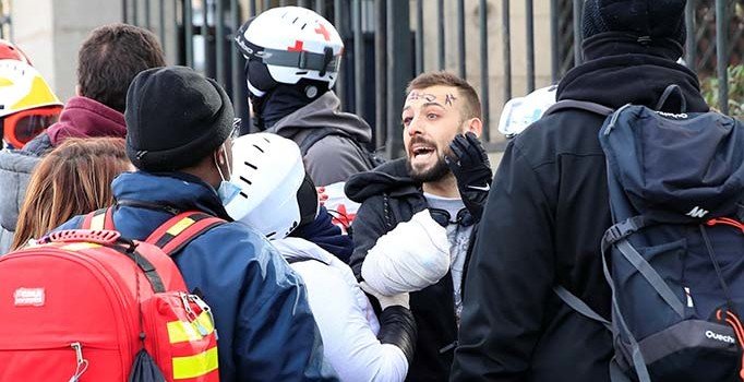 Sarı Yelekliler'e sert müdahale! Bir eylemcinin eli koptu