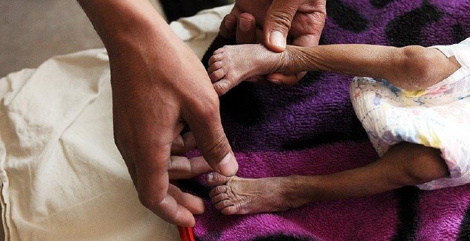 İHH'dan Yemen çağrısı