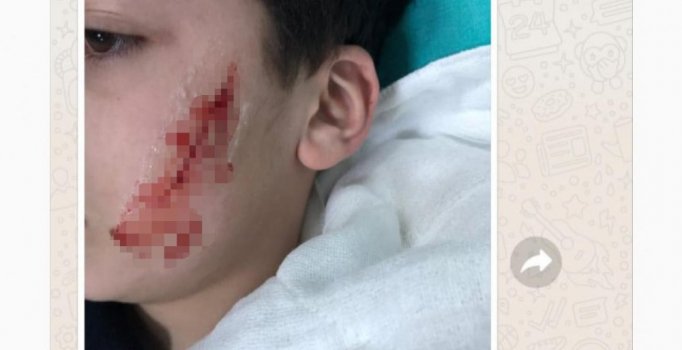 Sınıfta arkadaşını kalemtıraş ile yaraladı, sosyal medyada 'Momo' alarmı verildi