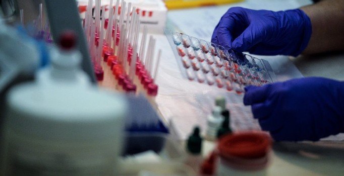 ABD'de Teva dahil 20 ilaç firmasına dava