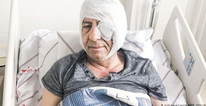 Gazeteci Demirağ’ı darp eden 6 saldırgan savcı talimatıyla serbest