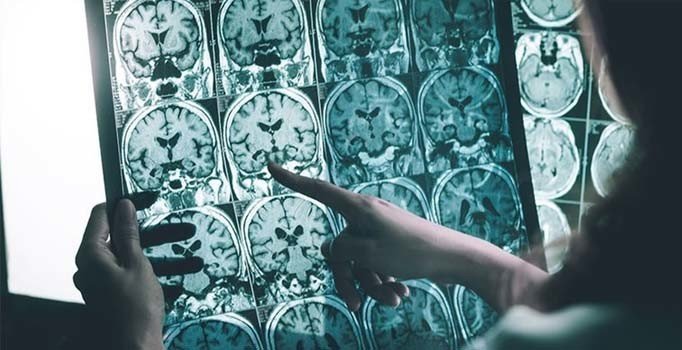 İçme suyunda Alzheimer riski