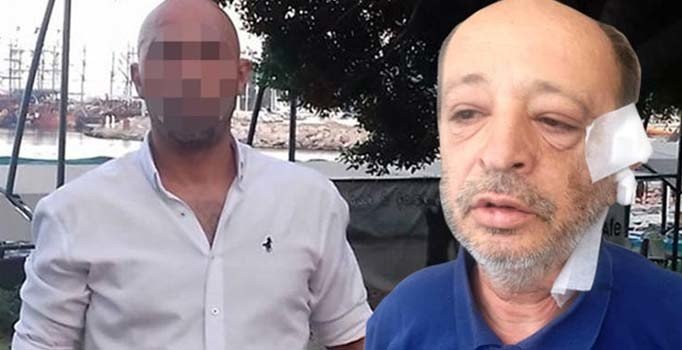 'İspiyoncunun sonu budur' diyerek kulağını kesti