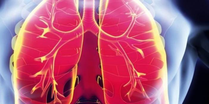 Akciğer sönmesi nedir? Belirtileri nelerdir, tedavisi nasıl yapılır?