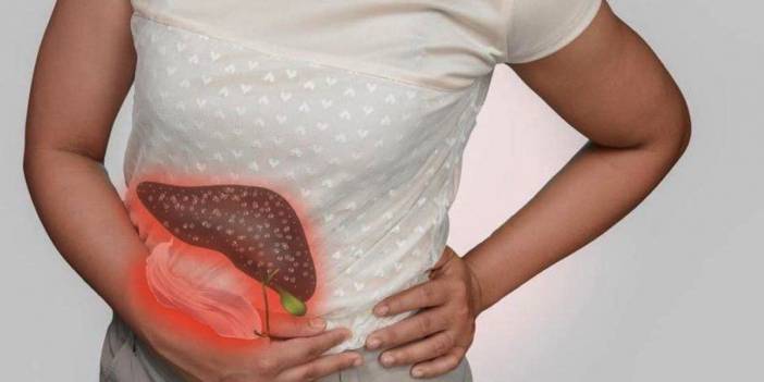 Siroz hastalığı nedir? Bulaşıcı mıdır, belirtileri neler?