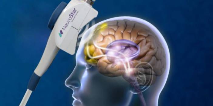 TMS tedavisi nedir?