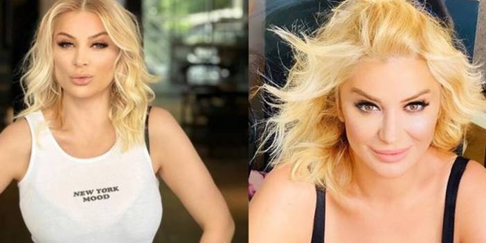 Songül Karlı'nın yaşını duyanlar şaşkına dönüyor! Eski halinden eser yok estetik harikası...