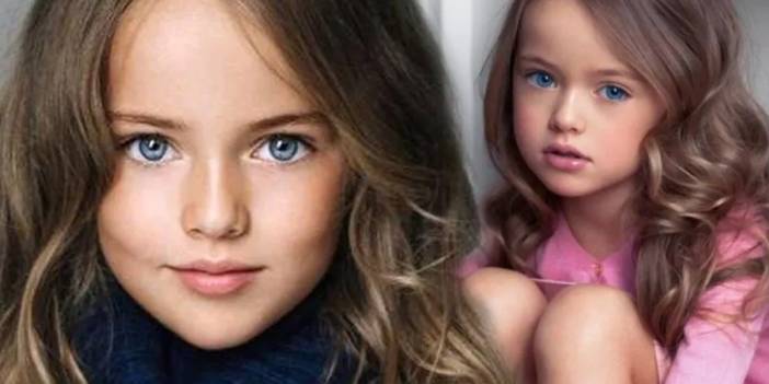 Dünyanın yaşayan en güzel kız çocuğuydu! Son haliyle ağızları açık bıraktı!