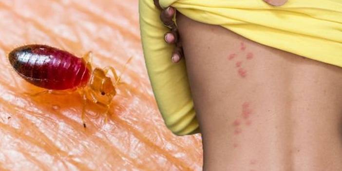 Yatağınızı saran böceklerden kurtulmak çok kolay! Geceleri uykunuzu bölen yatak böceklerinden hızlıca kurtulabilirsiniz