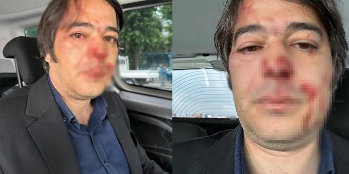 Kaçak yapı yıkımında İBB müdürüne darp: Kafe sahipleri tarafından saldırıya uğradı